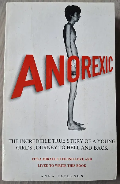 Книга Anorexic: The True Story Of An Anorexia Survivor Who Found Love